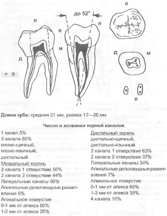 Каналы 17 зуба. Анатомия устьев корневых каналов 26 зуба. моляр верхней челюсти анатомия. анатомия корневых каналов моляров верхней челюсти.