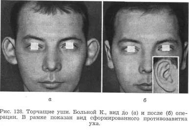 Как называются торчащие уши