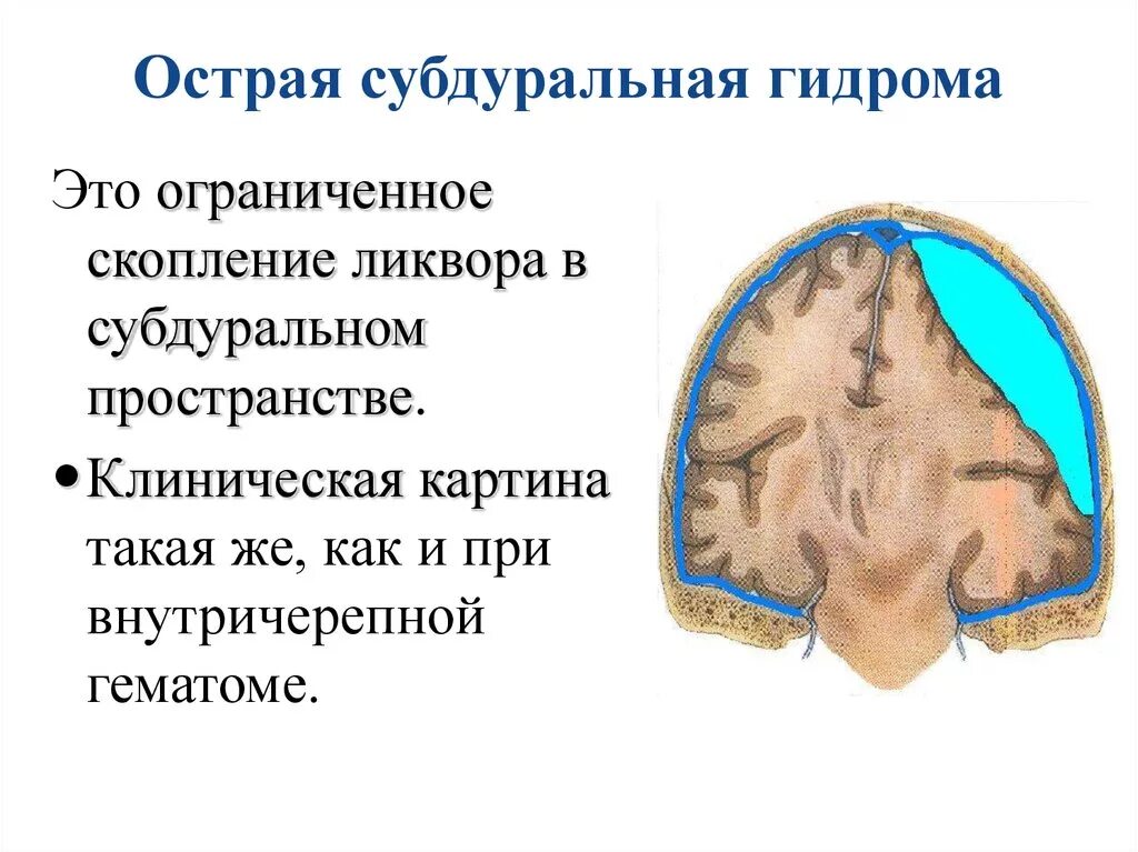 Субдуральное пространство спинного мозга. Субдуральная гидрома ЗЧЯ. Субдуральное и субарахноидальное пространства. Эпидуральное субдуральное субарахноидальное пространство.