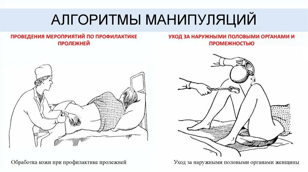 Алгоритм выполнение манипуляции. Алгоритм выполнения манипуляций по профилактике пролежней. профилактика пролежней у тяжелобольных алгоритм. алгоритм выполнения пролежней профилактика сестринское. алгоритм обработки лежачего пациента.