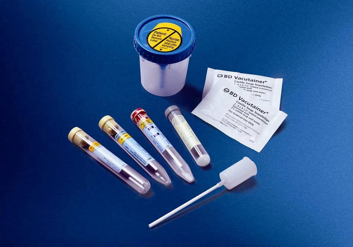 Иглы в моче. Пробирка вакутайнер для мочи. Контейнер bd Vacutainer urine collection Cup. Vacutainer пробирки для мочи. Bd Vacutainer пробирки для мочи.