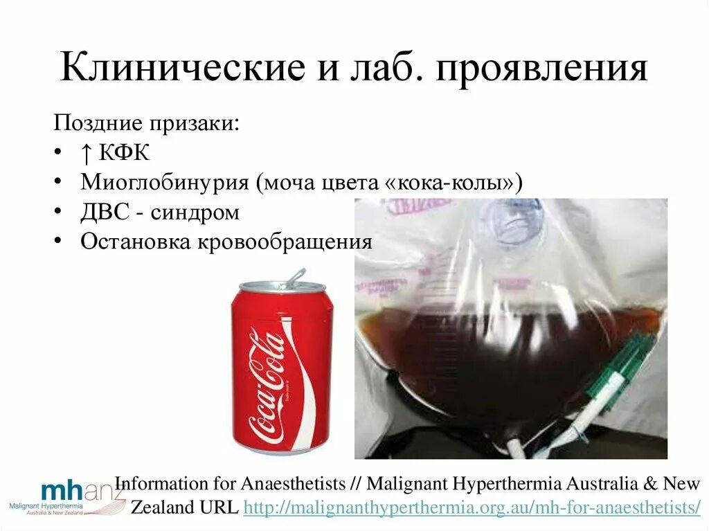 Coca cola 3d model. Кока кола моча. Кока кола моча. Кока кола в железных банках. Опыт кока кола и молоко.