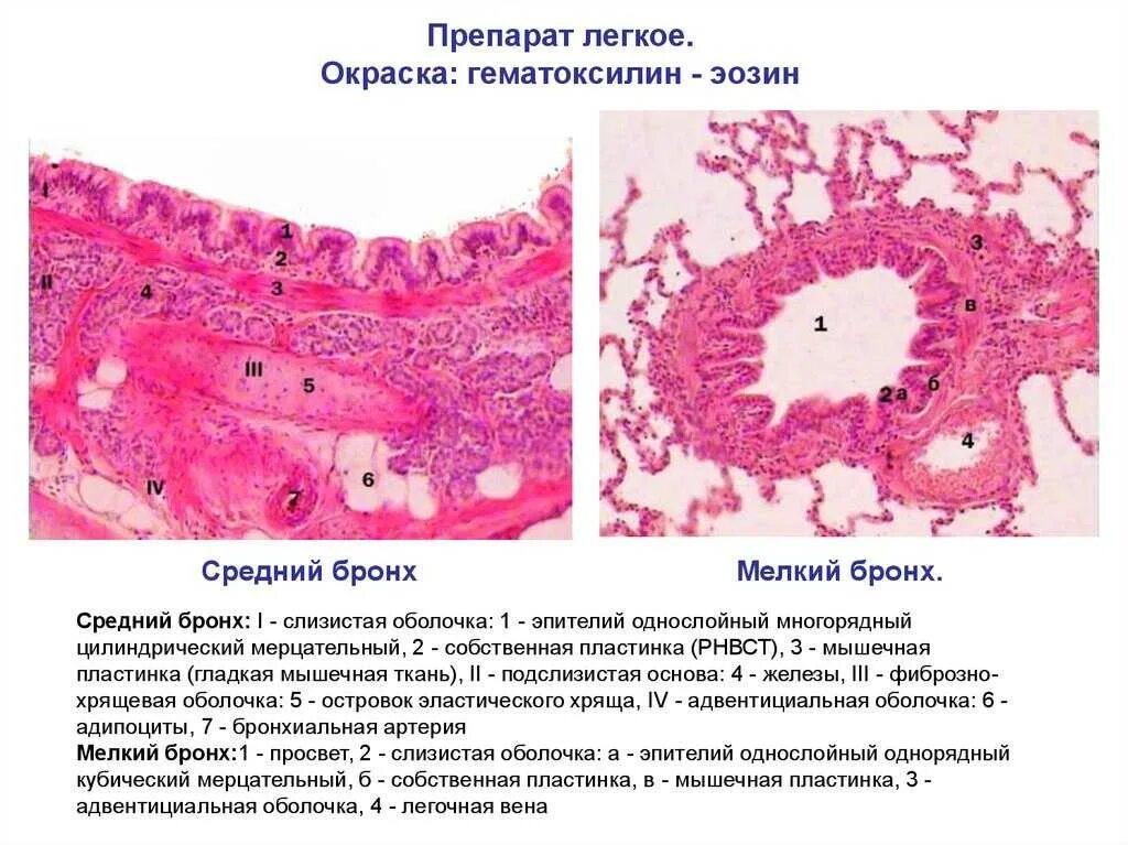 Легкое гистологический препарат. Бронхи гистология препарат. Препарат легкое окраска гематоксилин-эозин. Строение бронха гистология.