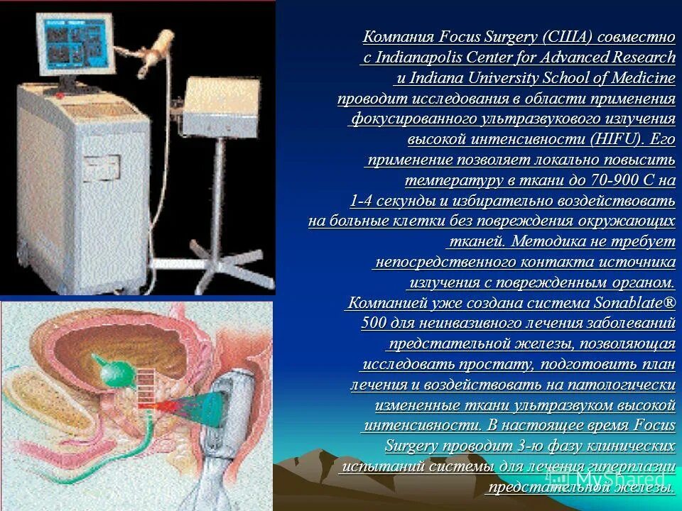 Ультразвук как проходит. Источники ультразвука в медицине. фокусированный ультразвук высокой интенсивности. ультразвуковое излучение применение. ультразвук в медицине кратко.