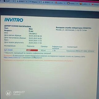 Иммуноглобулин е инвитро