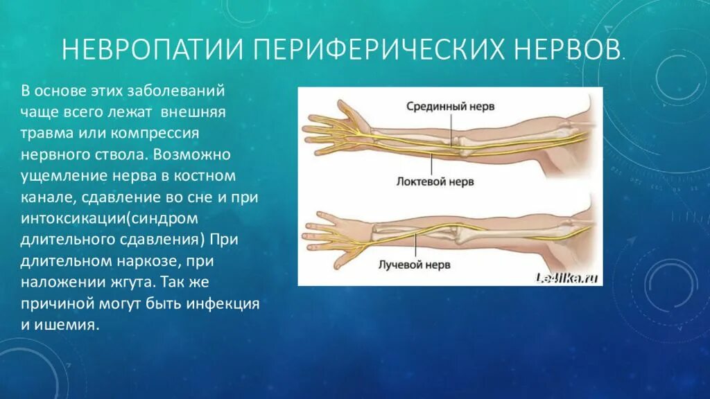 Неврит периферических нервов конечностей. Невропатия срединного периферического нерва. Невропатия локтевого и лучевого нерва. Периферические нервные стволы.