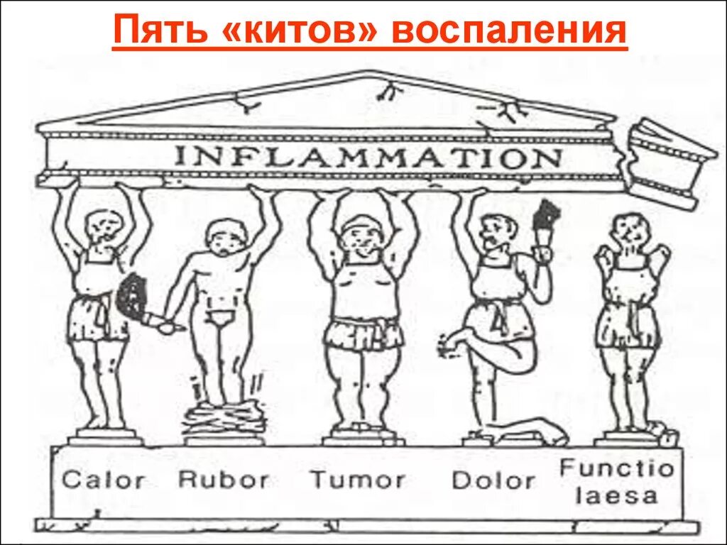 Признак воспаления dolor. Воспаление тумор Рубор. Воспаление tumor rubor calor dolor functio laesa. 5 Признаков воспаления.