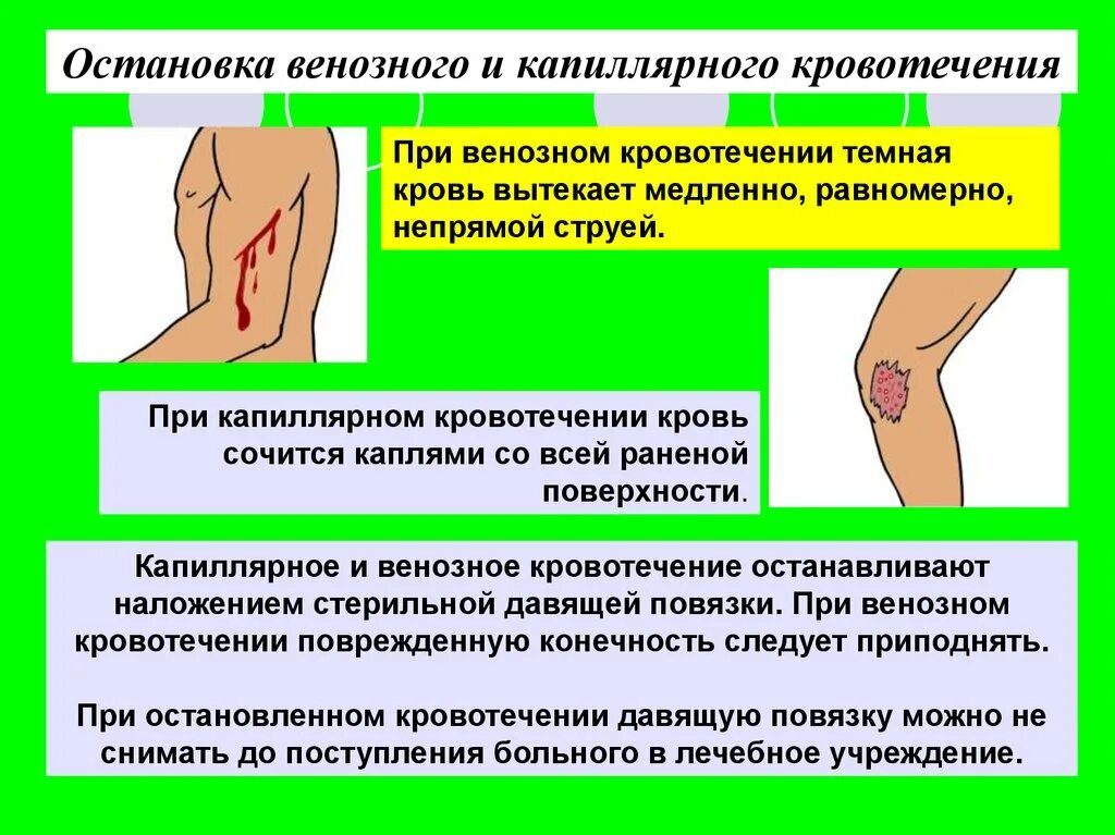 Остановка венозного кровотечения. Остановка веозногокровотечения. Как Остановить венозное кровотечение. Остановка кровотечения при венозном кровотечении. Кровотечение остановить дома