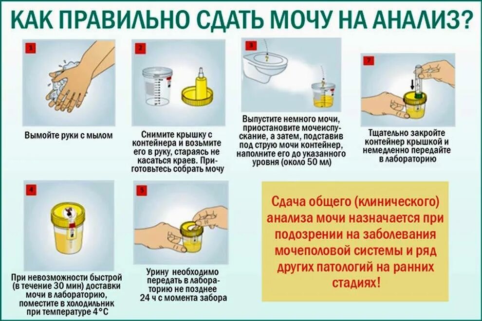 Анализ мочи время сдачи