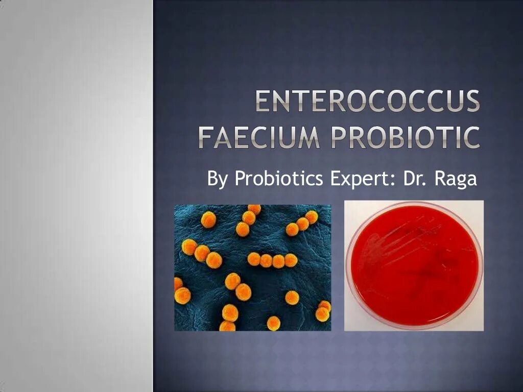 Кишечная палочка энтерококк. Энтерококк фэциум. Enterococcus faecium микробиология. Энтерококки микробиология заболевания. Энтерококк фекум.