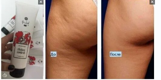 Крем жжет