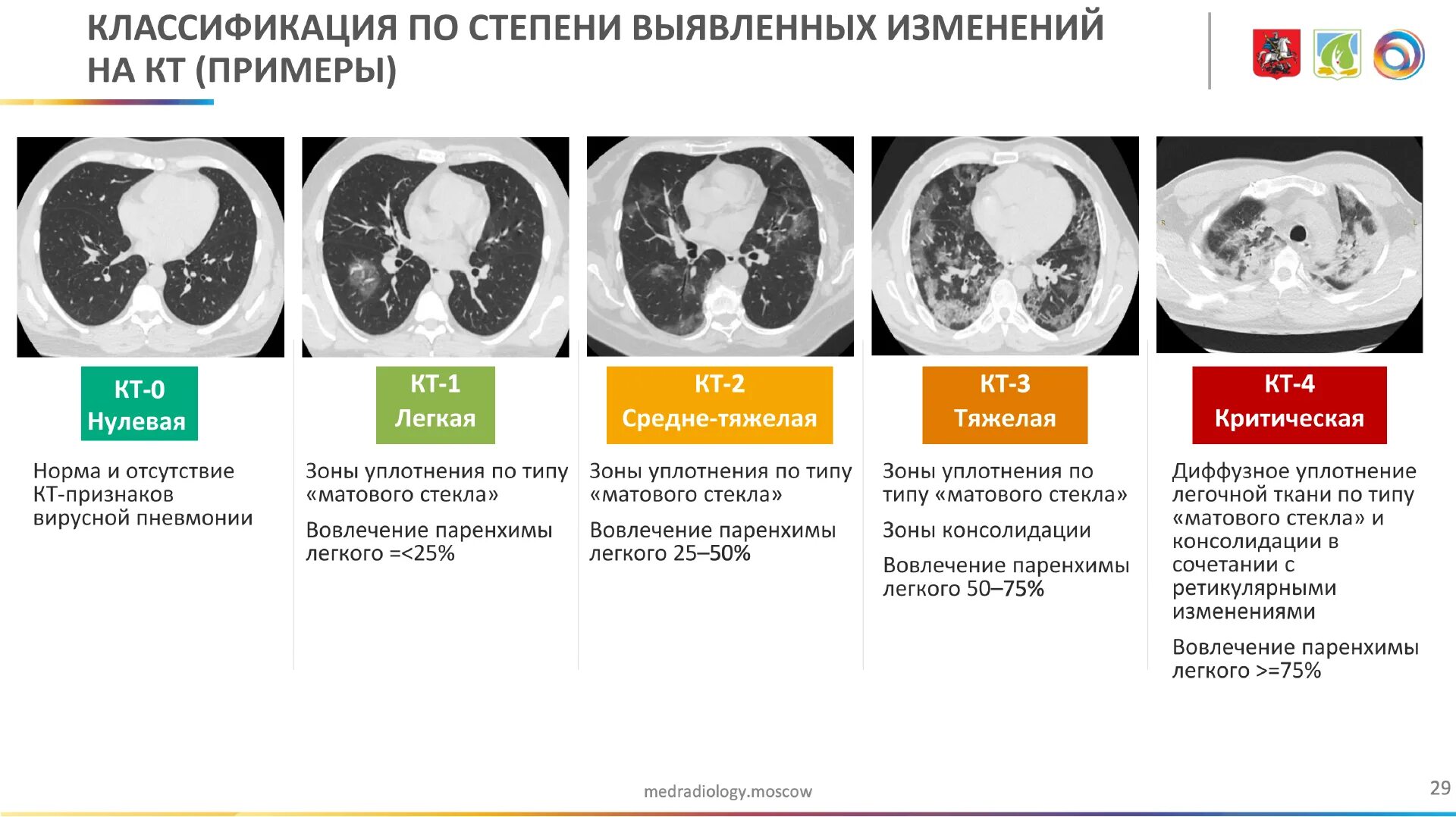 Поражение легких на кт при коронавирусе. Степени поражения пневмония по кт. Поражение легких при кт коронавирус. Степень ковид пневмонии кт.