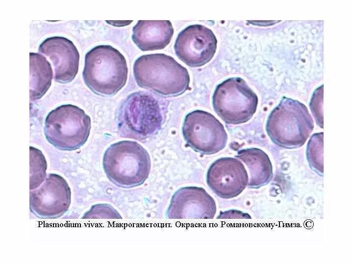 Риккетсии романовский гимза. Borrelia по романовского-гимза. Метод окраски романовского гимзе. Окраска по романовскому-гимзе микробиология. Хламидии романовскому гимзе.