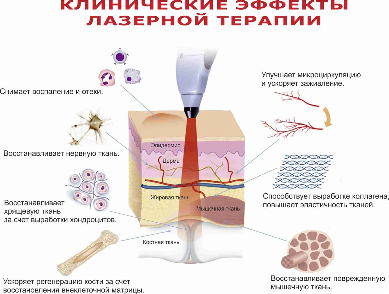 Лазер влияет. Действие лазерного излучения на биологические ткани. воздействие лазера на биологические ткани. полезное действие лазера. лечебное действие лазерного излучения.
