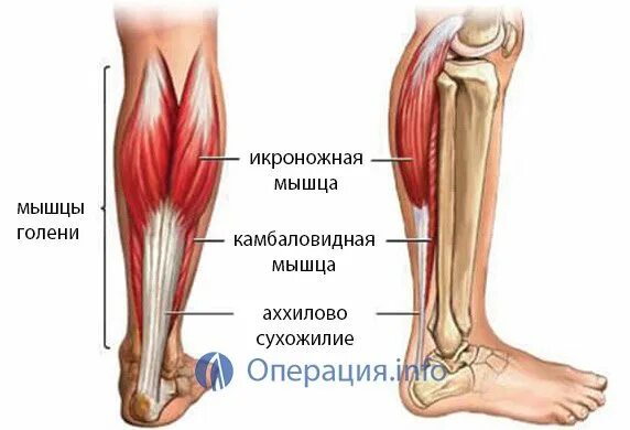 Укороченное сухожилие. Ахиллово сухожилие разрыв. Надрыв разрыв ахиллова сухожилия. Ахиллово сухожилие травма. Ахиллесово сухожилие порвал.