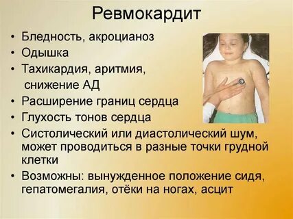Ревматизм пороки