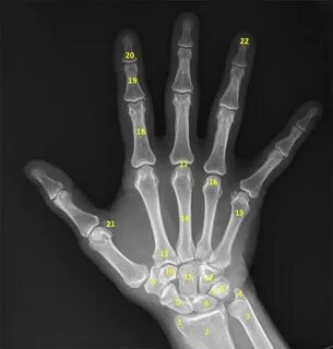 Hand 10
