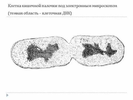 Клетка кишечной палочки