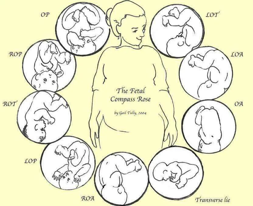 Как лежит малыш в животе. Положение ребенка в животе. Положениеребннкавживоте. Положение ребёнка в живоье.