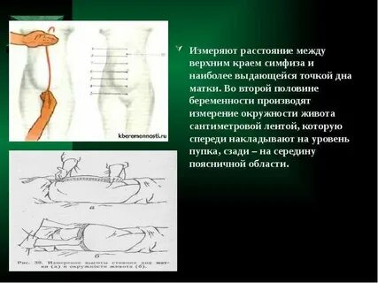 Ож и вдм