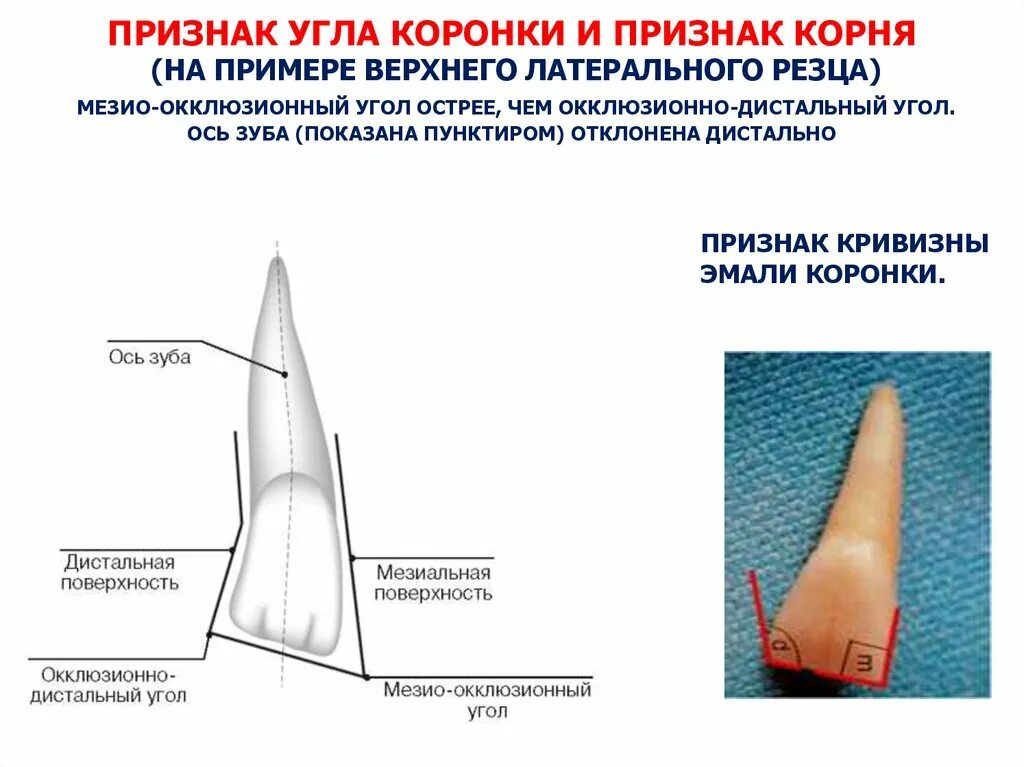 Признаки стороны зуба. Признак угла корня зуба. Признак угла коронки зуба. Признаки кривизны зуба. Признак кривизны коронки зуба рисунок.