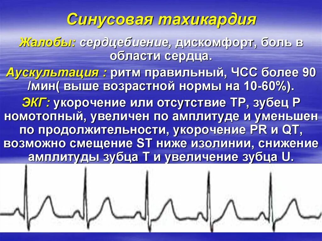 Сильный пульс что делать. Синусовая тахикардия. Ритм синусовая тахикардия. Синусовая тахикардия сердца что это такое. При синусовой тахикардии :.