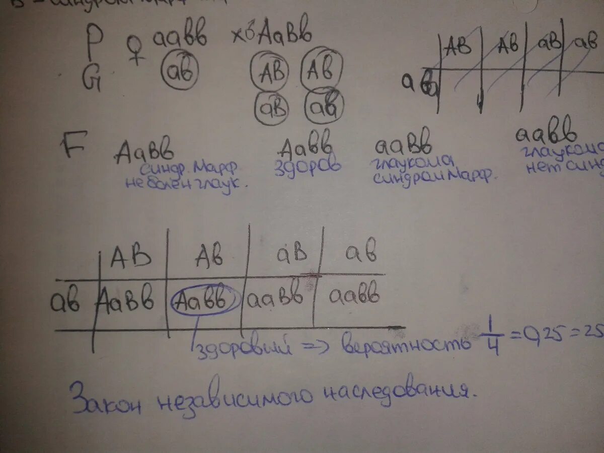 Один из супругов страдает глаукомой