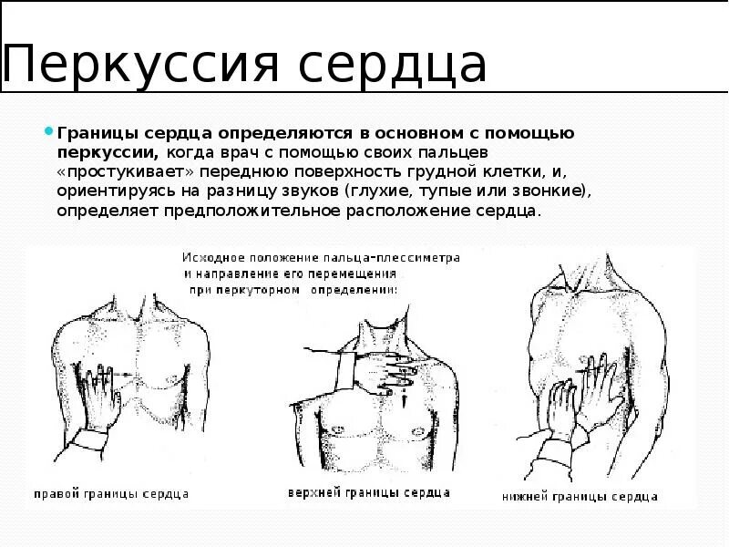 Сердечный узнать