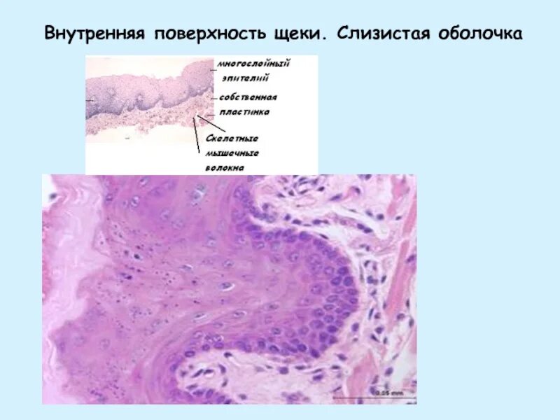 Слизистой оболочки щеки. Слизистая оболочка щеки. Слизистая щеки гистология.