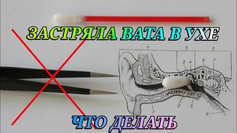 Вата в ушах