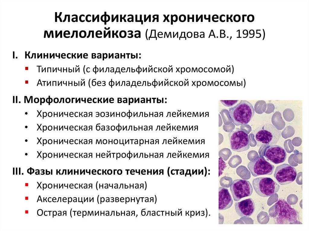 Хронический миелоцитарный лейкоз классификация. Острый лейкоз классификация картина крови. Хронический миелолейкоз и острый лейкоз. Хронический миелолейкоз показатели лейкоцитов.