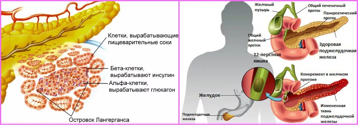 Функции поджелудочной железы СД 1. Панкреатический сахарный диабет. Поджелудочная железа сахарный диабет рисунок. Поджелудочная железа инсулин и глюкагон.