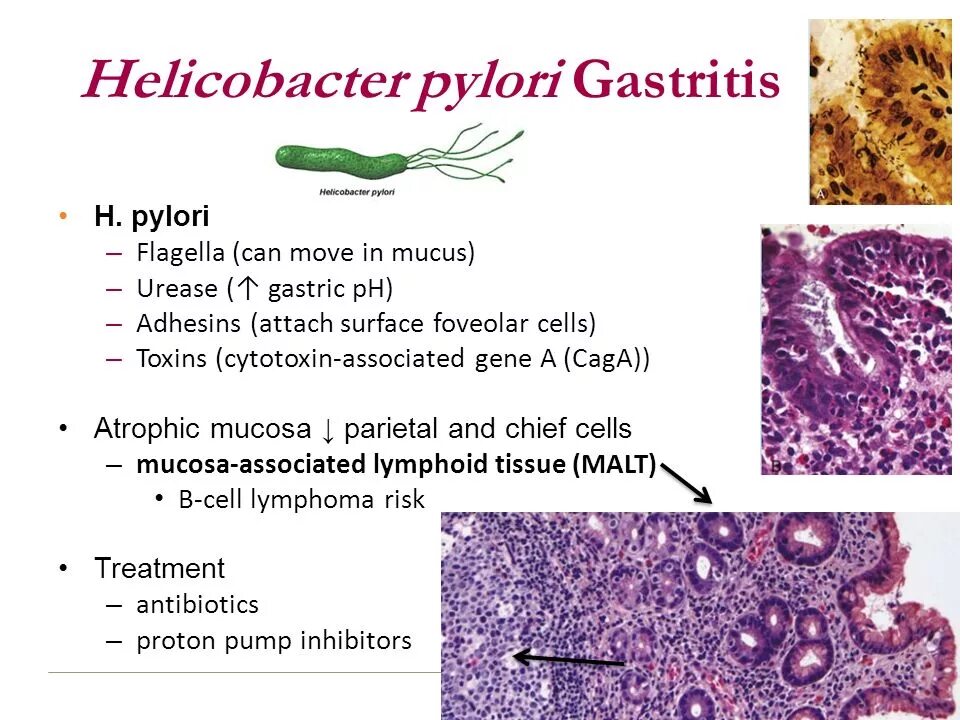 Хеликобактер пилори погибает. Helicobacter pylori колонизируется в. Перитрихи хеликобактер пилори. Хеликобактер пилори гистология Гимза. Гастрит бактерия Helicobacter.