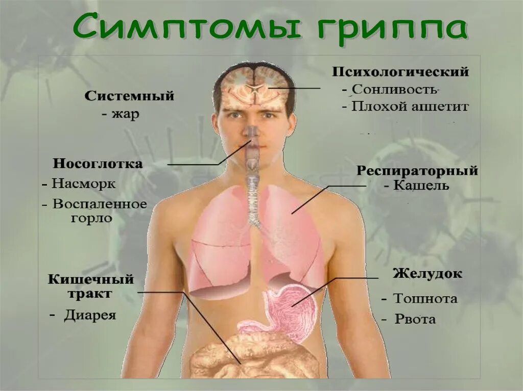 Как проявляется грипп а симптомы. Свиной грипп. симптомы гриппа. симптомы гриппа презентация. свиной грипп симптомы.