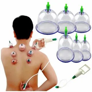 Вакуумные массажные банки антицеллюлитные косметические 12 шт KZ0918 - купить в 