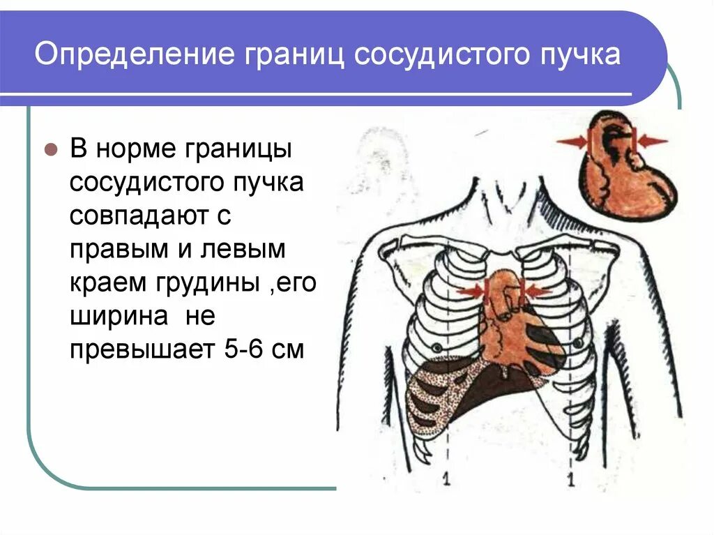 Определение сердечно