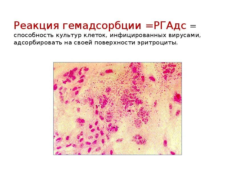 Почему вирусы не инфицируют эритроциты