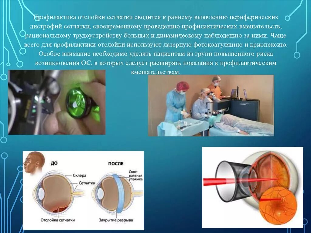 Отслойка сетчатки этиология клиника. Периметрия отслойка сетчатки. Основными методами диагностики отслойки сетчатки являются. Нерегматогенная отслойка сетчатки.