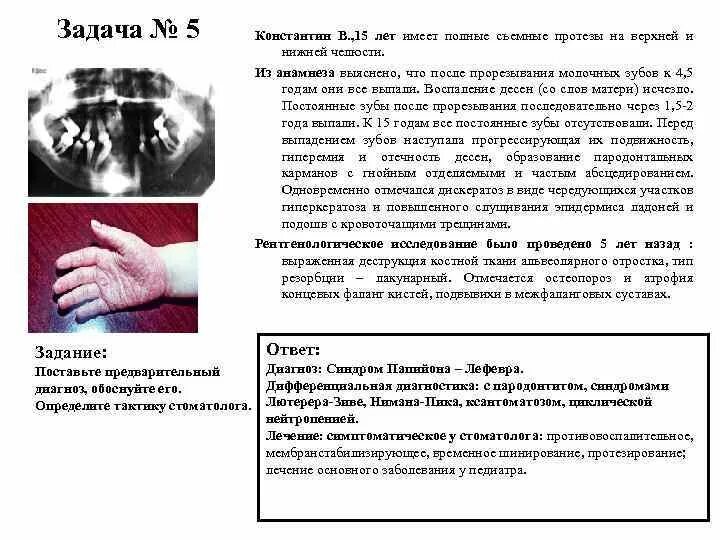 Болезненная задача. Постановка предварительного диагноза в травматологии. Предварительной диагностики стоматолога. Генетические заболевания с поражением кистей руками. Анамнез заболевания при зубной боли.