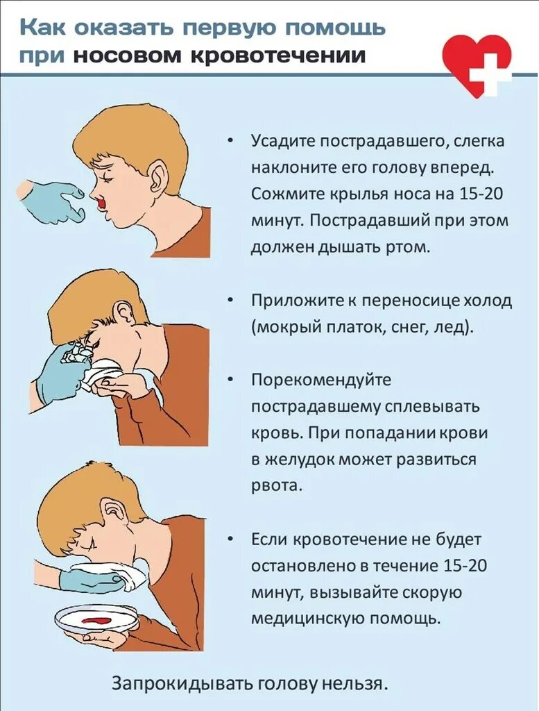 Носовое кровотечение время