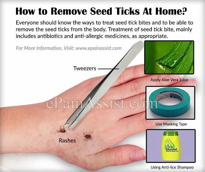 Tick bite make you allergic to. Tick bite make you allergic to