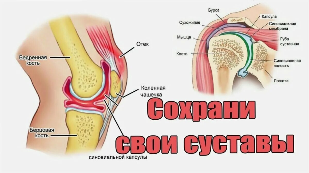 Скрип в коленях. Суставы. Здоровые суставы. Здоровый сустав колена.