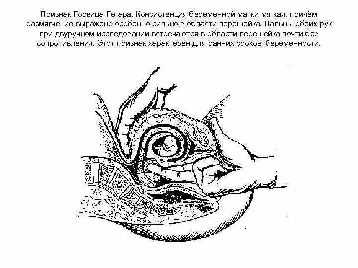 Изменение матки при беременности