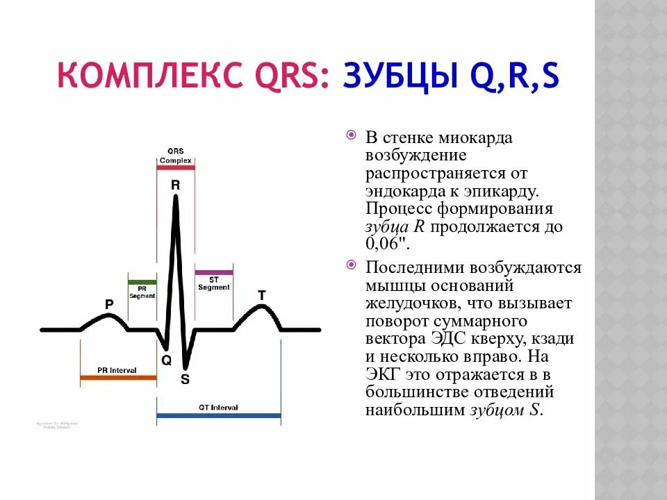 Изменение комплекса qrs. Зубец q на экг в норме. патологический комплекс qrs на экг. зубец qrs на экг норма. измененный комплекс qrs на экг.
