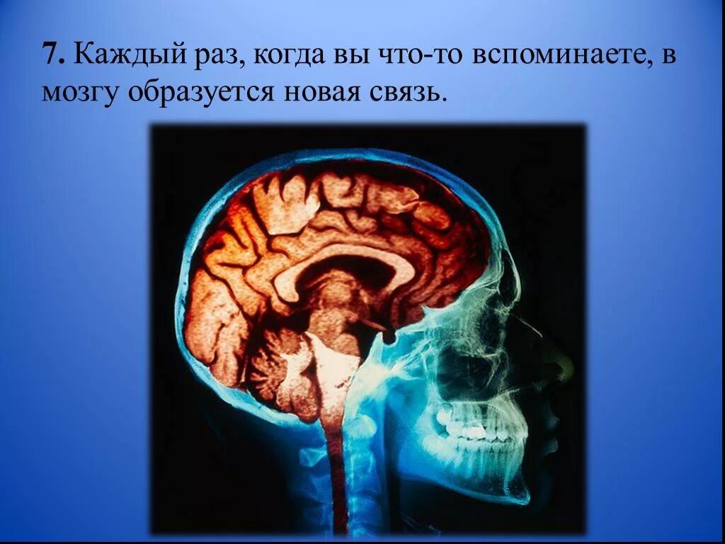 Интересные факты о головном мозге. Факты о человеческом мозге. Интересные факты о головном мозге проект. Интересные факты про мозг 2 класс.