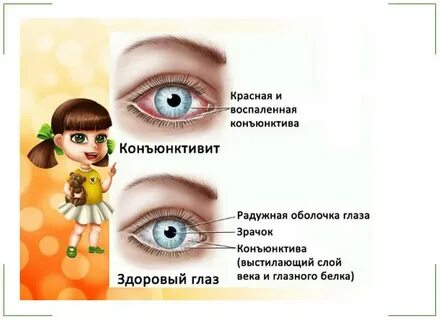 Через сколько пройдет глаз