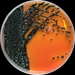 Klebsiella oxytoca
