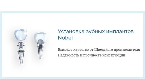 Импланты тверь