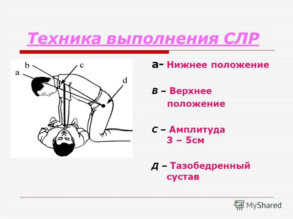 Алгоритм проведения реанимации. Для проведения ивл при слр выделяется. Схема этапов базовой слр. Частота компрессий при проведении сердечно-легочной реанимации. Для проведения ивл при слр выделяется.