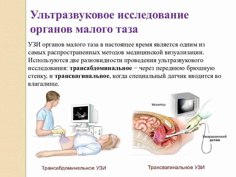Ультразвуковое исследование матки и придатков трансабдоминальное. Ультразвуковое исследование малого таза. Трансабдоминальное УЗИ малого таза. УЗИ придатков трансабдоминальное что это